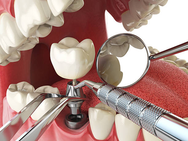 Best Tooth Pain Emergency Relief  in Richmond Hill, GA
